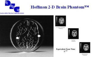 Hoffman 2D脑模体